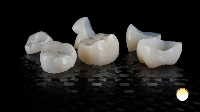 Dental Crowns 3