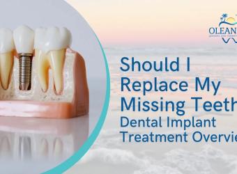 Should I Replace My Missing Teeth? Dental Implant Treatment Overview